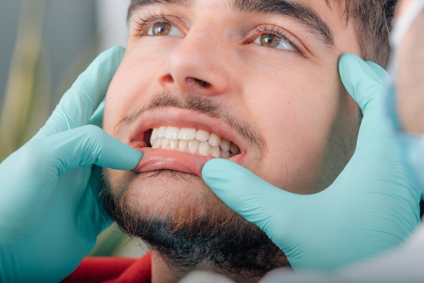 How Often Are Dental Exams Needed?