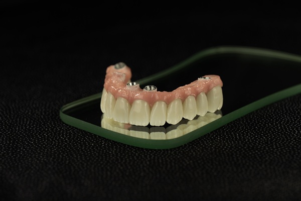 Fixed Vs Removable Implant Supported Dentures
